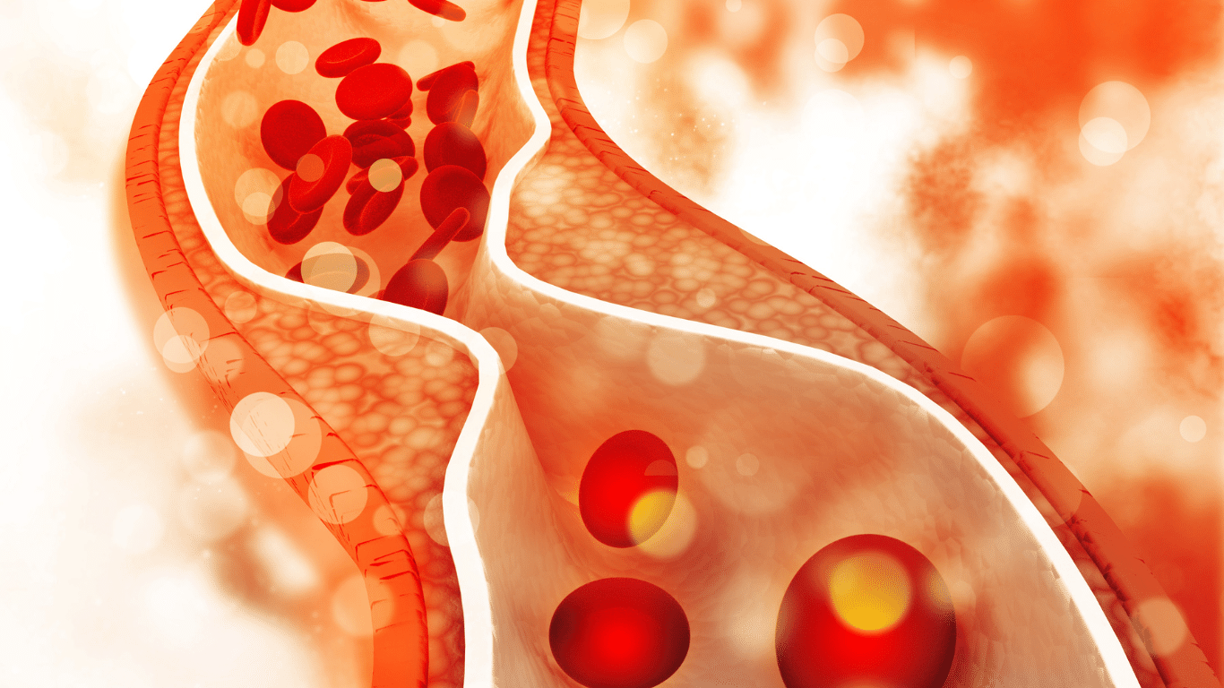 Cholesterol